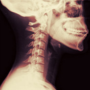 Neck X-Ray